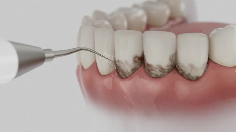 Reliable Emergency Dentist contractor in Chester, SC by Smile Center Dentistry